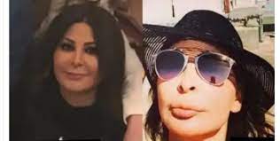 بسبب عمليات التجميل.. أول تعليق من إليسا على الساخرين من شكل فمها وشفتيها يفاجئ الجميع! | الفن واهله