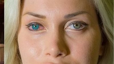 عارضة أزياء تتخلى عن جمالها وتخضع لـ 18 عملية تجميل لتحصل على أصغر خصر