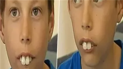 شاهدوا شكله بعد أن كبر