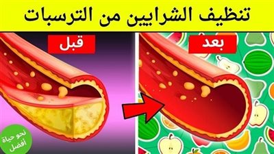 اطعمة تنظيف الشرايين والحفاظ عليها ١١ طعام لا يفوتك