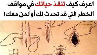 +10 أساليب ذكية لإنقاذ الحياة في مواقف الخطړ التي قد تحدث بدون مقدمات