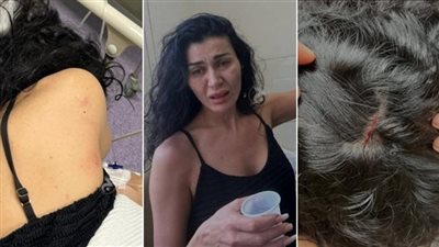 تعليق نا ري من نادين الراسى بعد ضـ ـربها على يد شقيقها.. فاجئت كل الناس باللي كشفته